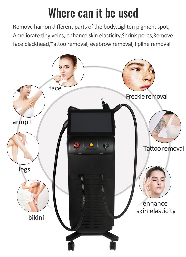 Classical Vertical High Energy Q Switch and 808nm Laser Hair Removal Machine